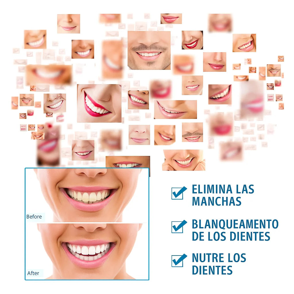 Teeth White™ Lápiz Blanqueador de Dientes